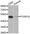 High affinity immunoglobulin gamma Fc receptor I antibody, LS-C331344, Lifespan Biosciences, Western Blot image 