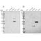Regucalcin antibody, PA5-56056, Invitrogen Antibodies, Western Blot image 