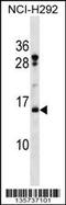 Histone Cluster 2 H2B Family Member F antibody, 58-399, ProSci, Western Blot image 