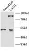 LAS1 Like, Ribosome Biogenesis Factor antibody, FNab04703, FineTest, Immunoprecipitation image 