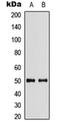 Solute Carrier Family 29 Member 2 antibody, orb234831, Biorbyt, Western Blot image 