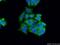 BAF Chromatin Remodeling Complex Subunit BCL7B antibody, 11740-1-AP, Proteintech Group, Immunofluorescence image 