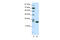 Cyclin Dependent Kinase 5 antibody, 28-885, ProSci, Western Blot image 