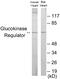 Glucokinase Regulator antibody, EKC1808, Boster Biological Technology, Western Blot image 