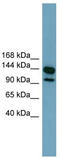 Leucine Rich Repeat Containing 66 antibody, TA336061, Origene, Western Blot image 