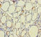 Thyroid Peroxidase antibody, LS-C679872, Lifespan Biosciences, Immunohistochemistry paraffin image 