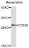 CD320 Molecule antibody, STJ111350, St John