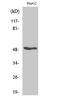 Retinoic Acid Receptor Beta antibody, STJ95373, St John