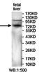 Kelch Repeat And BTB Domain Containing 8 antibody, orb78139, Biorbyt, Western Blot image 