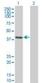 CLN3 Lysosomal/Endosomal Transmembrane Protein, Battenin antibody, H00001201-M03, Novus Biologicals, Western Blot image 