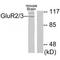 Metabotropic glutamate receptor 3 antibody, A04827, Boster Biological Technology, Western Blot image 