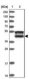 Family With Sequence Similarity 53 Member B antibody, NBP1-88976, Novus Biologicals, Western Blot image 