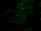 Cathepsin E antibody, GTX33064, GeneTex, Immunofluorescence image 