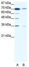 Dpc4 antibody, TA329742, Origene, Western Blot image 