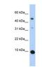 C-C Motif Chemokine Ligand 2 antibody, NBP1-79938, Novus Biologicals, Western Blot image 