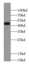 Voltage-dependent L-type calcium channel subunit alpha-1C antibody, FNab04892, FineTest, Western Blot image 