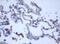 Probable ATP-dependent RNA helicase DDX59 antibody, M12681, Boster Biological Technology, Immunohistochemistry paraffin image 