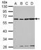 GC Vitamin D Binding Protein antibody, NBP2-20864, Novus Biologicals, Western Blot image 