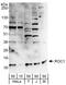 Ring-Box 1 antibody, A303-462A, Bethyl Labs, Western Blot image 