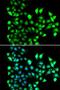 Small Nuclear Ribonucleoprotein D2 Polypeptide antibody, LS-C748409, Lifespan Biosciences, Immunofluorescence image 