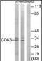 Cyclin Dependent Kinase 5 antibody, orb95565, Biorbyt, Western Blot image 