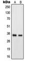 G Protein-Coupled Receptor 82 antibody, orb215133, Biorbyt, Western Blot image 