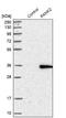 Pantothenate Kinase 2 antibody, NBP1-88295, Novus Biologicals, Western Blot image 