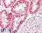 Mitochondrially Encoded NADH:Ubiquinone Oxidoreductase Core Subunit 6 antibody, LS-B8197, Lifespan Biosciences, Immunohistochemistry paraffin image 