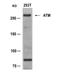 Serine-protein kinase ATM antibody, TA347854, Origene, Western Blot image 