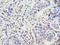 ZFP69 Zinc Finger Protein B antibody, A63996-100, Epigentek, Immunohistochemistry paraffin image 
