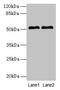 Solute Carrier Family 30 Member 6 antibody, CSB-PA744010LA01HU, Cusabio, Western Blot image 