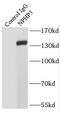 Nephrocystin 3 antibody, FNab05816, FineTest, Immunoprecipitation image 