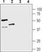 Arginine Vasopressin Receptor 1B antibody, PA5-77762, Invitrogen Antibodies, Western Blot image 