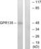 G Protein-Coupled Receptor 135 antibody, abx015301, Abbexa, Western Blot image 