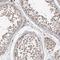 Charged multivesicular body protein 4c antibody, HPA023799, Atlas Antibodies, Immunohistochemistry frozen image 