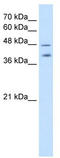 Pregnancy Specific Beta-1-Glycoprotein 1 antibody, TA346443, Origene, Western Blot image 