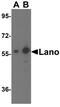 Leucine Rich Repeat Containing 1 antibody, A13956, Boster Biological Technology, Western Blot image 