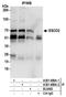 Establishment Of Sister Chromatid Cohesion N-Acetyltransferase 2 antibody, A301-689A, Bethyl Labs, Immunoprecipitation image 