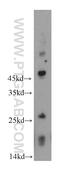 RING finger protein 170 antibody, 21024-1-AP, Proteintech Group, Western Blot image 