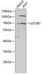 UDP Glucuronosyltransferase Family 2 Member B7 antibody, 16-805, ProSci, Western Blot image 