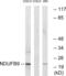 NADH:Ubiquinone Oxidoreductase Subunit B9 antibody, abx014630, Abbexa, Western Blot image 