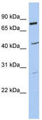 Coiled-Coil Domain Containing 63 antibody, TA338881, Origene, Western Blot image 