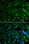 4-Hydroxyphenylpyruvate Dioxygenase antibody, 22-273, ProSci, Immunofluorescence image 