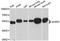Atypical Chemokine Receptor 3 antibody, STJ114585, St John