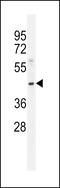 2-acylglycerol O-acyltransferase 3 antibody, 56-138, ProSci, Western Blot image 