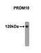 PR domain zinc finger protein 10 antibody, AM11040PU-N, Origene, Western Blot image 