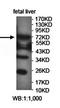 Zinc Finger And BTB Domain Containing 49 antibody, orb78464, Biorbyt, Western Blot image 