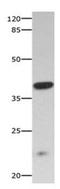 Ciliary neurotrophic factor receptor subunit alpha antibody, orb107375, Biorbyt, Western Blot image 