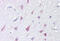 Nasopharyngeal carinmoma  antibody, MBS243877, MyBioSource, Immunohistochemistry frozen image 