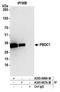 Polysaccharide Biosynthesis Domain Containing 1 antibody, A305-687A-M, Bethyl Labs, Immunoprecipitation image 